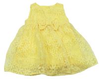 Žlté čipkové šaty F&F