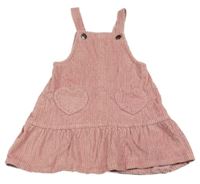 Ružové menšestrové šaty so srdiečkovanými vreckami Topomini