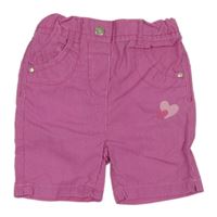 Ružové pruhované plátenné kraťasy